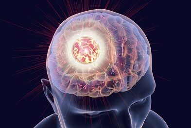Avec MindManager, le cerveau réconcilie les deux lobes émotif et rationnel